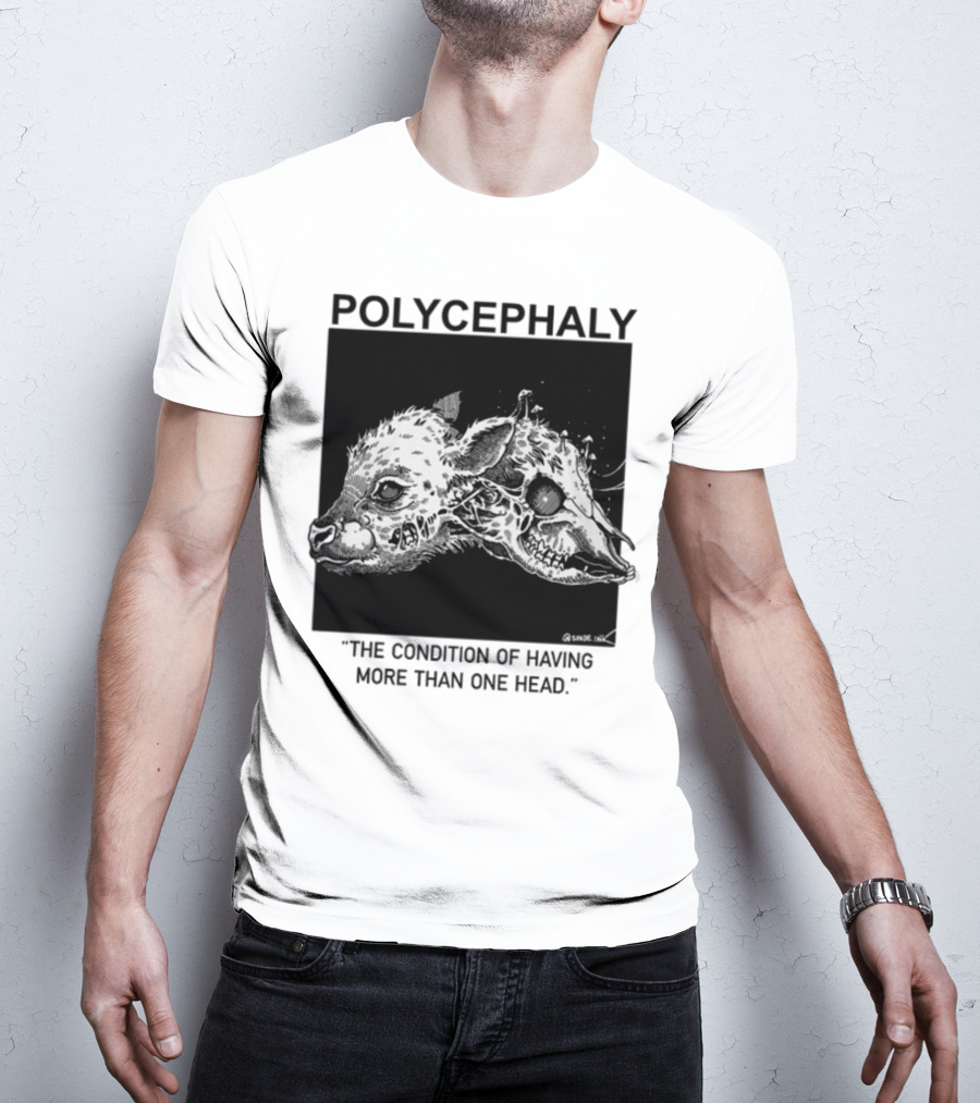 Polycephaly The Condition Of Having More Than One Head T-Shirt