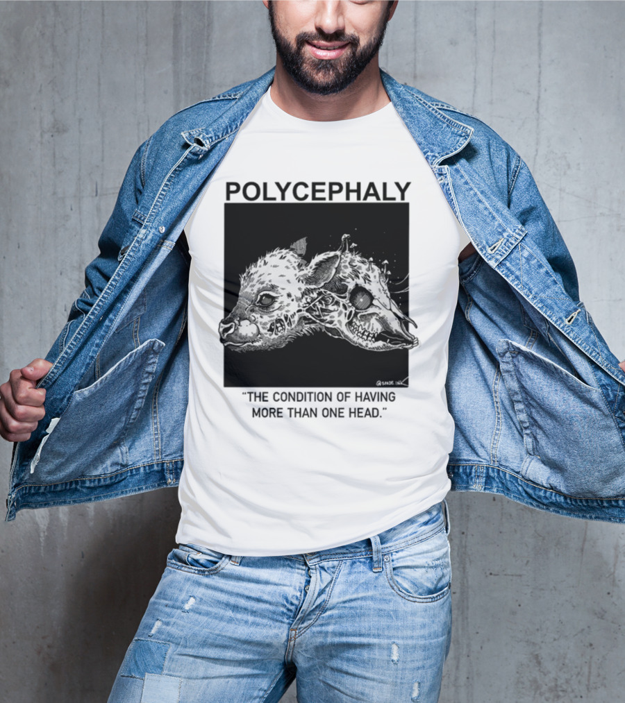 Polycephaly The Condition Of Having More Than One Head T-Shirt