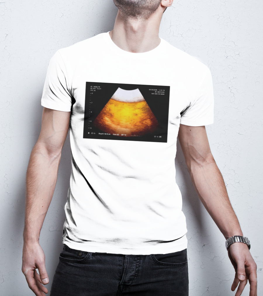 Beer Ultrasound Image Not Safe For Liver T-Shirt