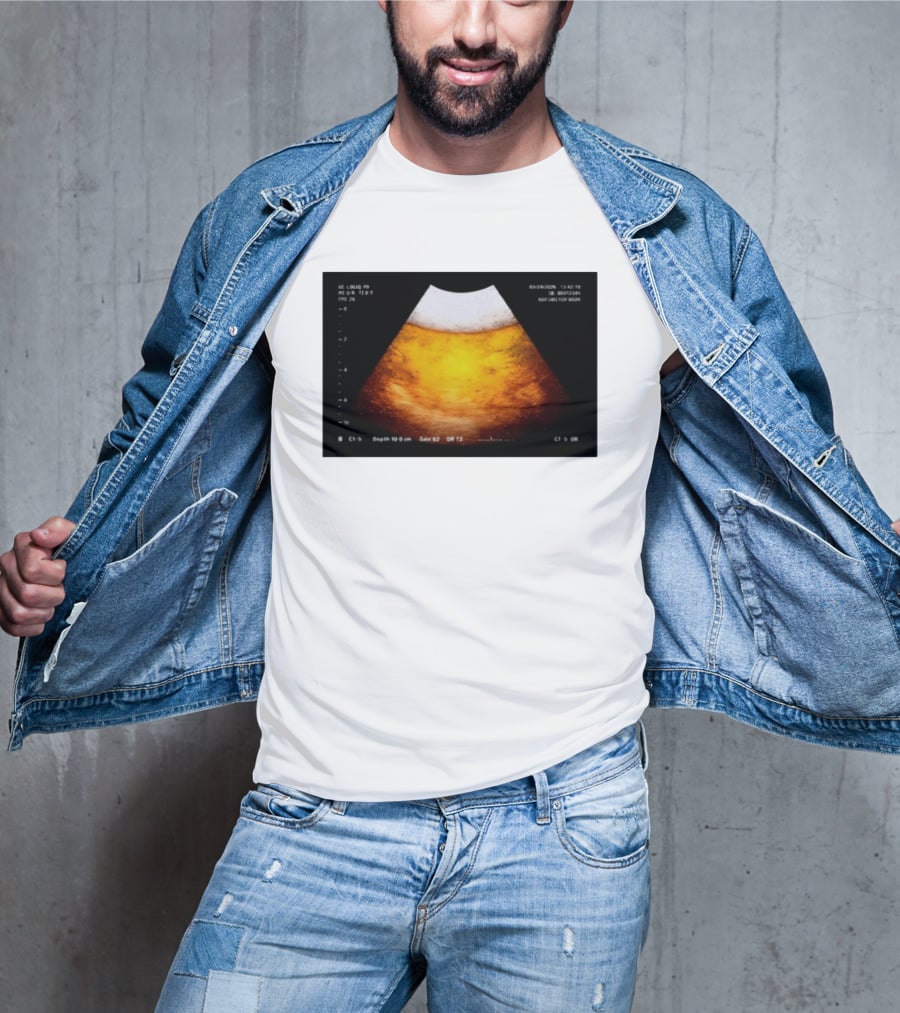 Beer Ultrasound Image Not Safe For Liver T-Shirt