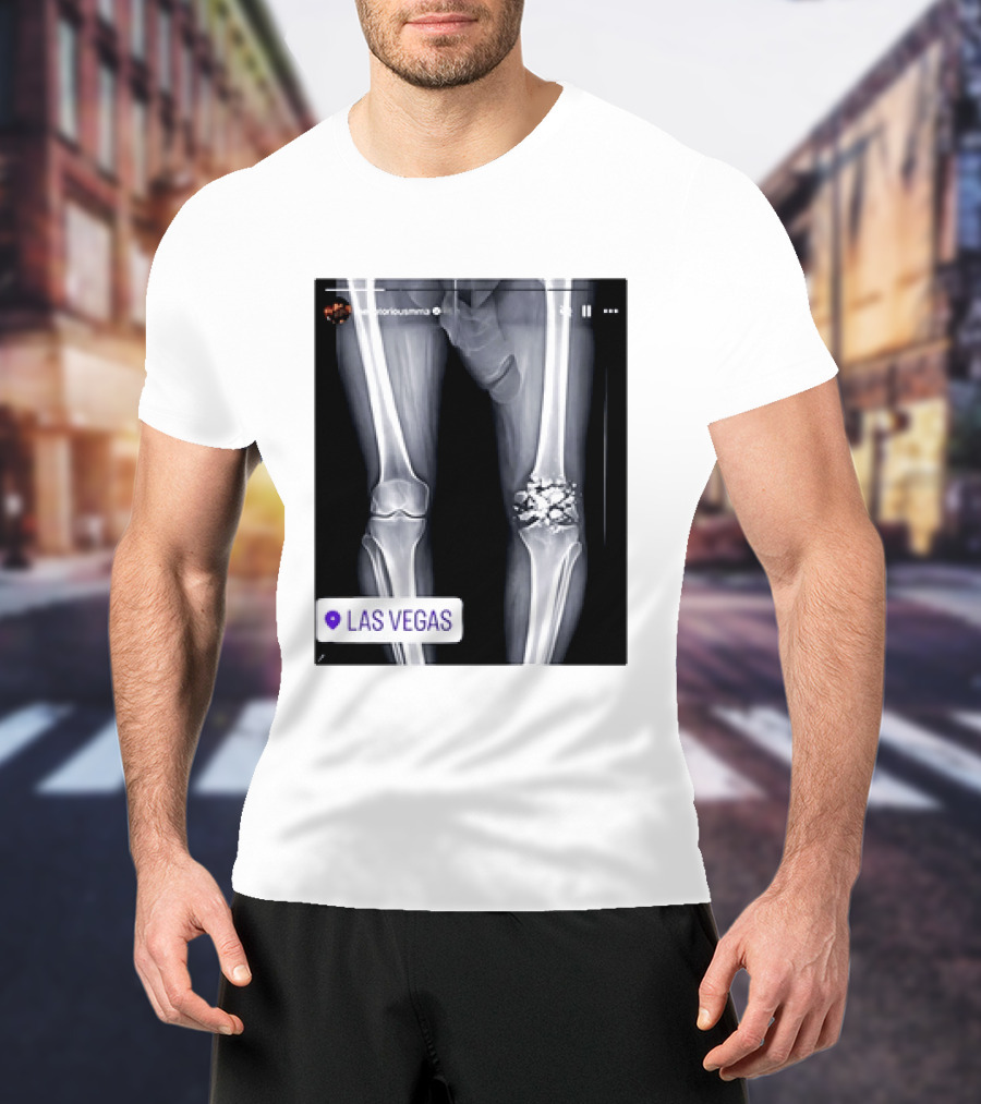 Conor McGregor X Ray Broken Knee Las Vegas T-Shirt