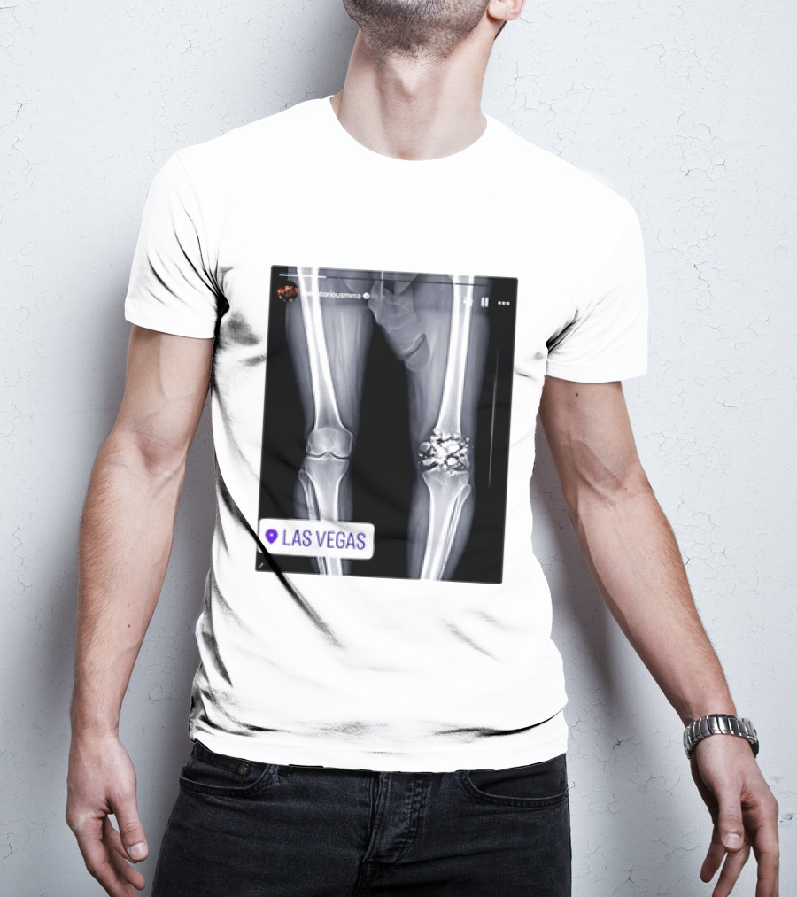 Conor McGregor X Ray Broken Knee Las Vegas T-Shirt
