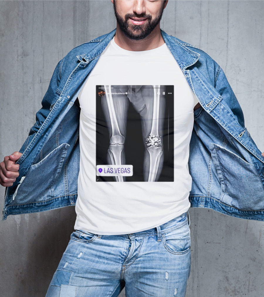 Conor McGregor X Ray Broken Knee Las Vegas T-Shirt